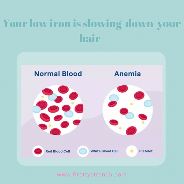 It's your low iron not your hair products!